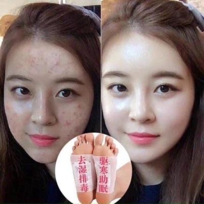 Hộp 50 miếng dán chân ngải cứu thải độc - T5