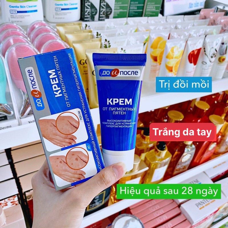 𝐊𝐞𝐦 𝐝ưỡ𝐧𝐠 𝐝𝐚 𝐭𝐚𝐲 𝐭𝐫ị đồ𝐢 𝐦ồ𝐢 𝐊𝐩𝐞𝐦 𝐜ủ𝐚 𝐍𝐠𝐚 𝟓𝟎𝐦𝐥