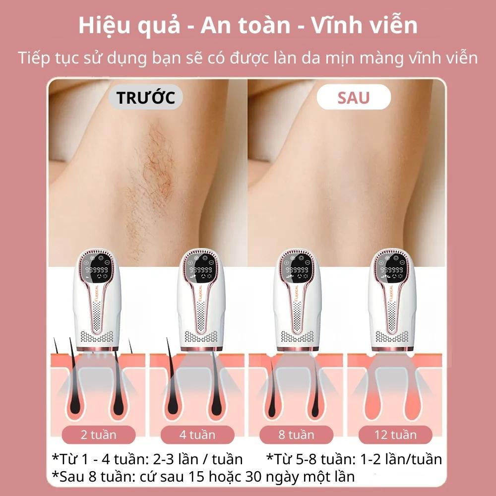 Máy triệt lông lạnh trẻ hóa da công nghệ IPL đá sapphire triệt lông cá nhân, an toàn cho da, vĩnh viễn tại nhà - podi92