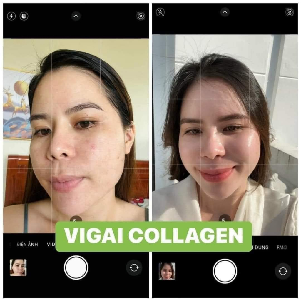 Kem dưỡng căng bóng da Perfect Retinol Rejuvenating Cream VI Collagen Dr Lacir Ylabcos chính hãng Dưỡng da trắng sáng