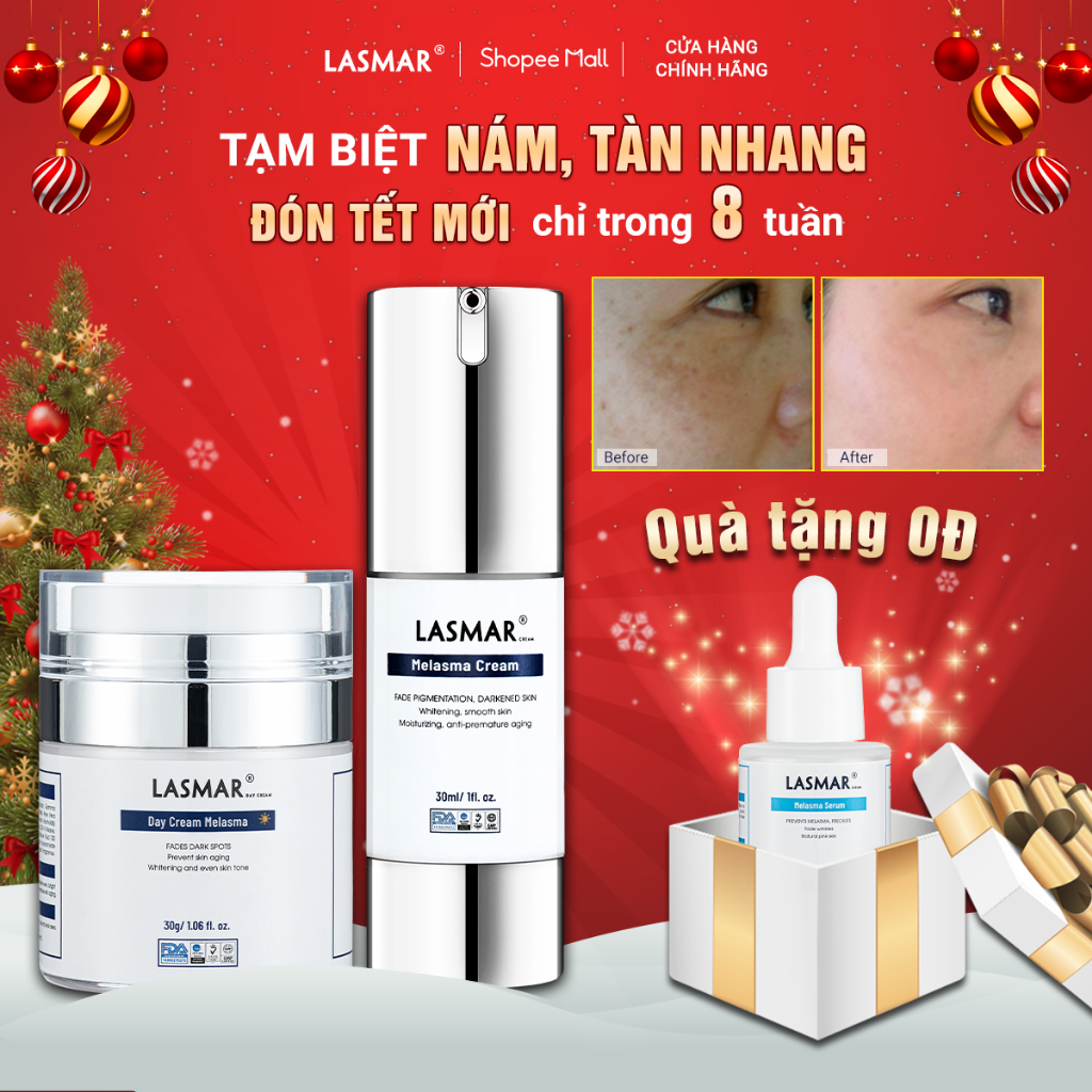 Combo 2 Kem Nám Ban Ngày, Đêm Lasmar Hỗ Trợ Mờ Nám Da, Sáng Da, Mờ Tàn Nhang Lâu Năm 30g