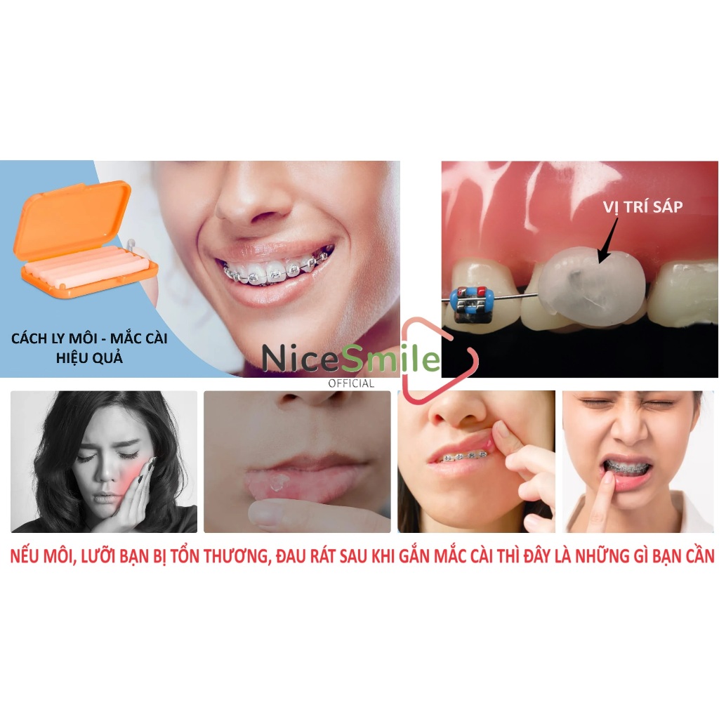 Sáp Chỉnh Nha Cho Người Niềng Răng, Sáp Giảm Đau Rát, Sáp Nha Khoa, Sáp Niềng Răng, Sáp Chỉnh Nha