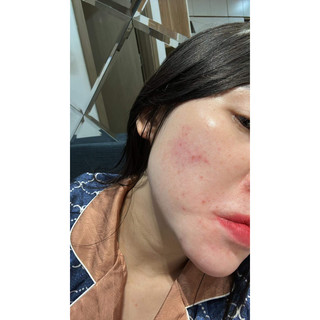Bộ Cốt Tươi Bạch Khiết Deva Cell