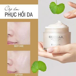 Kem Dưỡng Ẩm Chiết Xuất Rau Má Làm Dịu Da Dr.Pepti Centella Moist Soothing Gel Cream 70ml