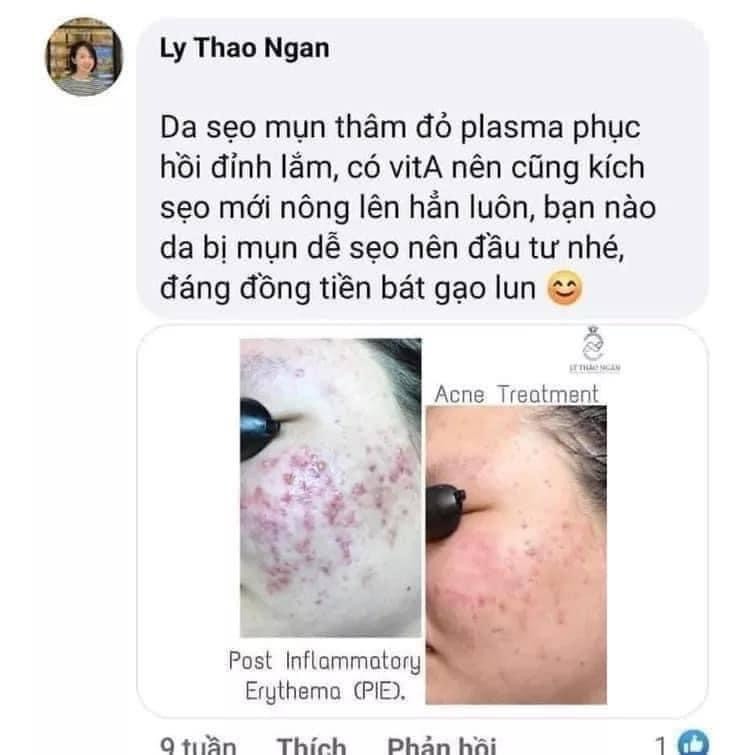 Huyết tương phục hồi da Evenswiss Regenerating Plasma 30-50-100ML