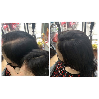 Phủ hói từ tóc thật, mái bay, mái dài