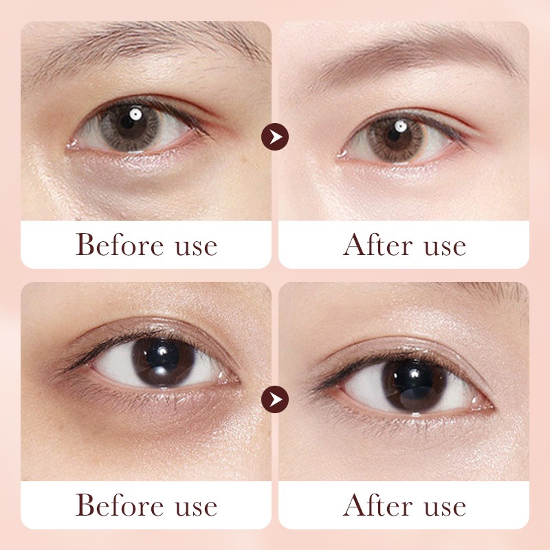 Kem dưỡng chống nhăn  chống lão hóa giảm thâm quầng mắt Sadoer Rentinol Anti - Wrinkle Eye Cream stick S20