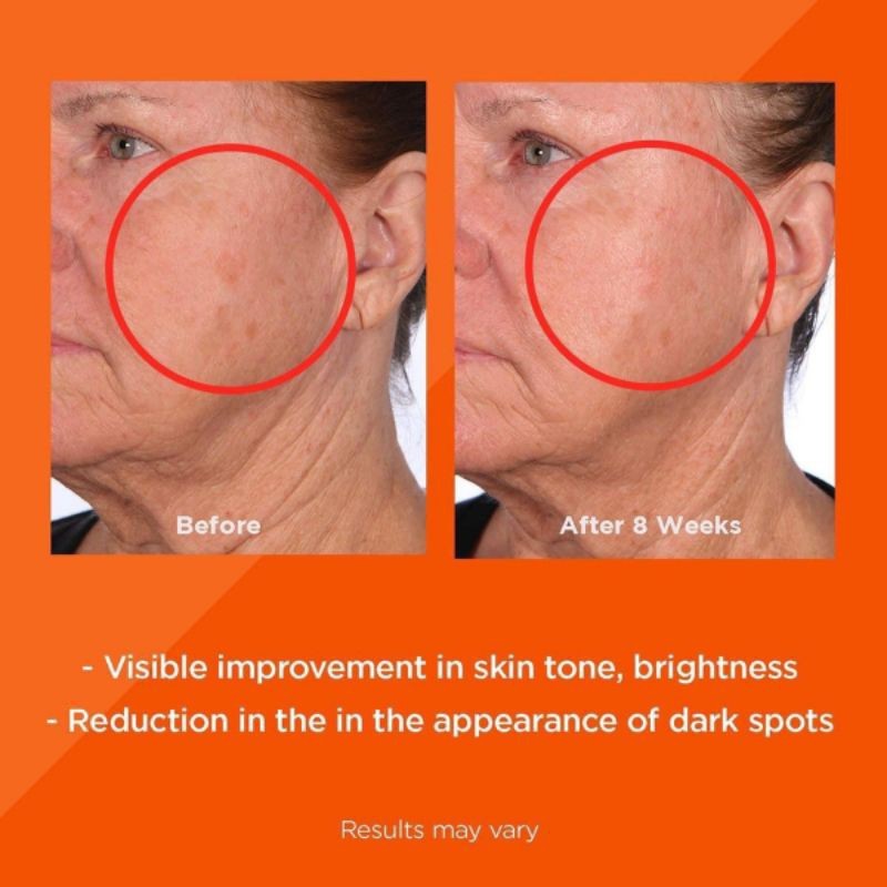 Ống 7 viên nang Tinh chất Vitamin C cô đặc cao cấp trắng da bật tone, mờ thâm sạm nám Elizabeth Arden