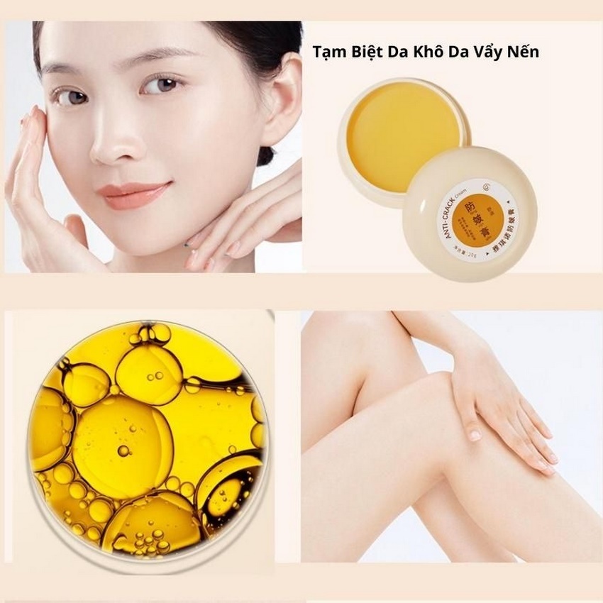 Kem Nẻ Gót Chân Phục Hồi Tái Tạo Da Nứt Nẻ Loại Bỏ Làn Da Chai Lì Thô Ráp SHEMIN