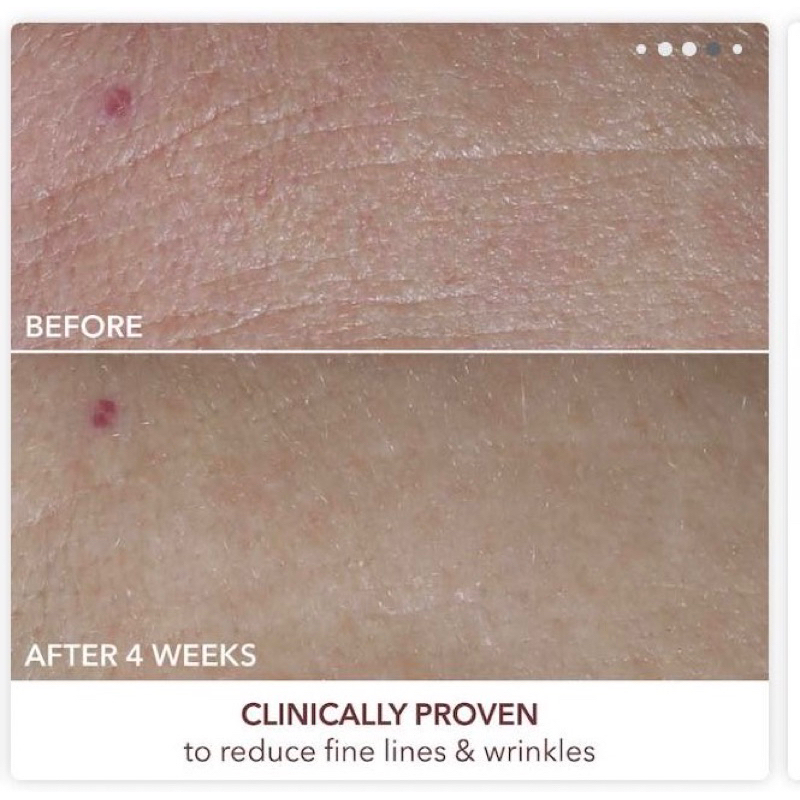 Dennis Gross Advanced Retinol + Ferulic Overnight pee.l tá.i tạo làn da mớ.i