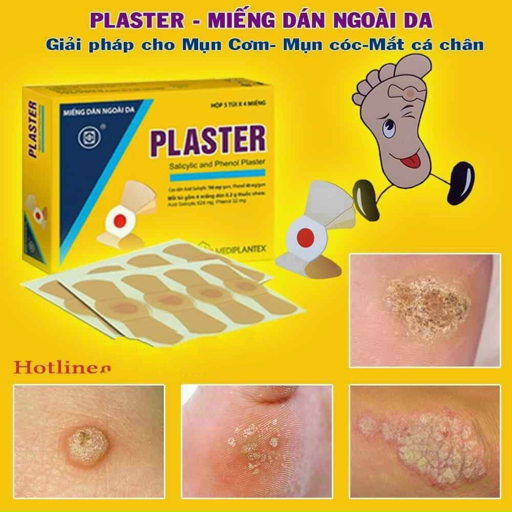 ✔ Plaster Miếng dán mụn cóc mụn cơm trên da ban chân bàn tay hộp 20 miếng
