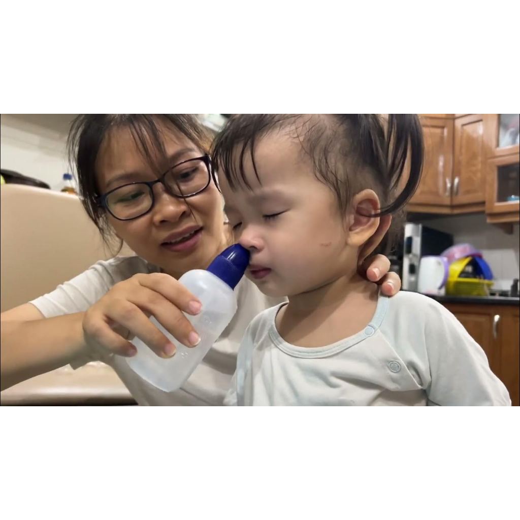 BÌNH RỬA MŨI SINUS RINSE BASIC - Thông Thoáng Mũi, Giảm Ngạt Mũi, Viêm Mũi, Viêm Xoang