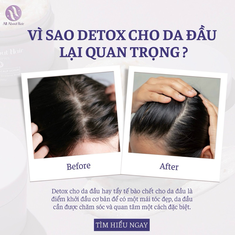 TẨY TẾ BÀO CHẾT DA ĐẦU - AAH SCALP SCRUB - All About Hair