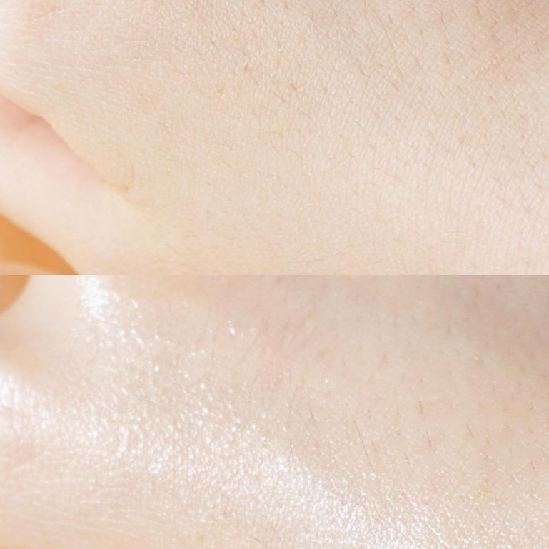 Serum mist Collagen Nấm Truffle DALBA