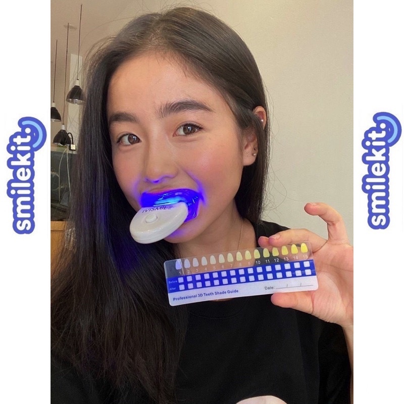 Máy Làm Trắng Răng SMILEKIT - Máy tẩy trắng răng làm sạch sâu hiệu quả nhanh chóng, bảo vệ men răng