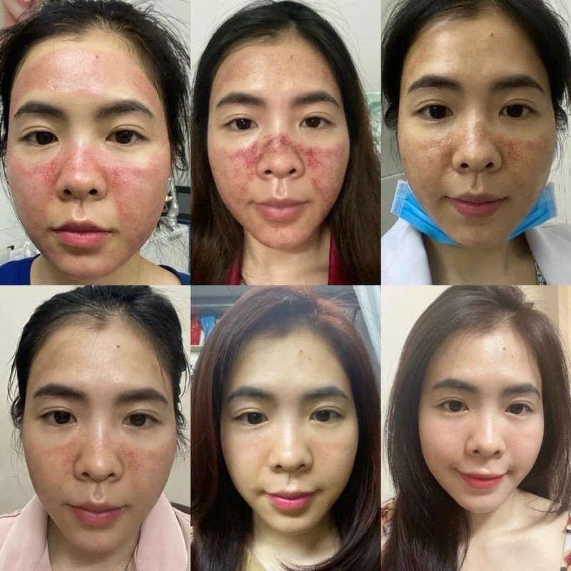 Sữa dưỡng dạng huyết thanh Plasma Evenswis