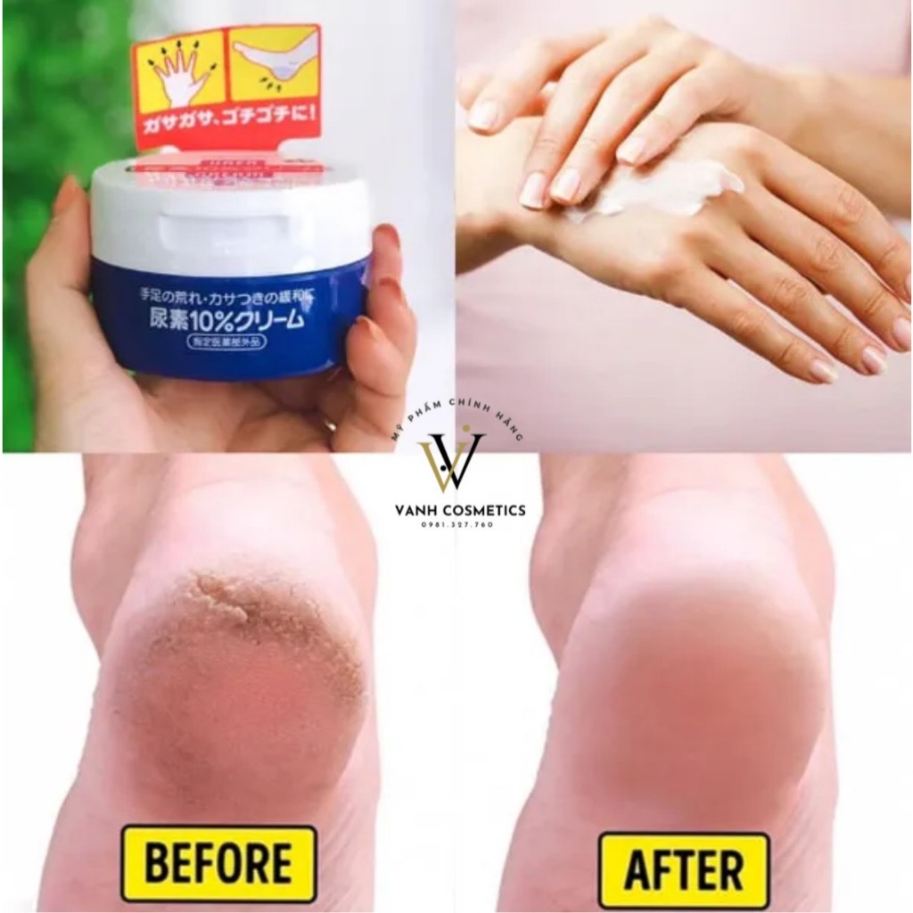 Kem Nẻ Gót Chân, Ngón Tay SHISEIDO UREA CREAM 100g HIỆU QUẢ LÀNH TÍNH - Nhật Bản