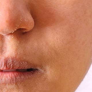 SÁP DƯỠNG ẨM ĐA CHỨC NĂNG VASELINE (HỦ LỚN 49G)