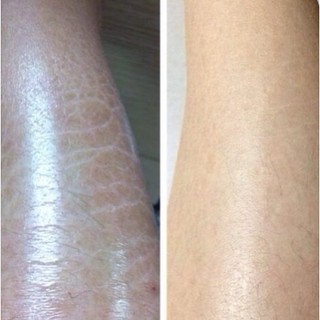 SÁP DƯỠNG ẨM ĐA CHỨC NĂNG VASELINE (HỦ LỚN 49G)