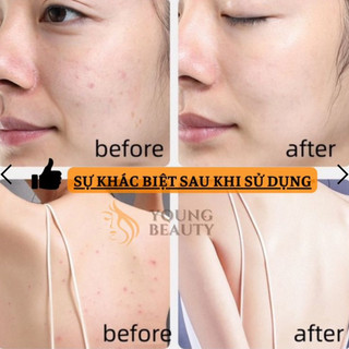Xà bông nhân sâm Hàn Quốc (2 hộp)
