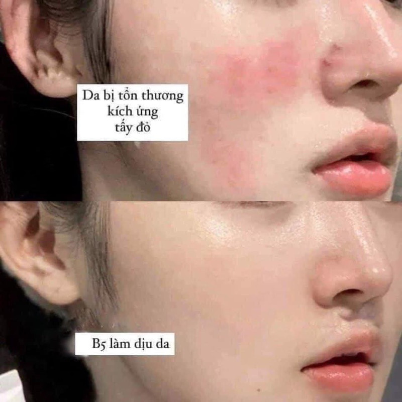 Serum Medik8 B5 mini 8ml