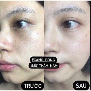 Tinh chất Peel Da Red Peel White Serum 11ml(11/2026)