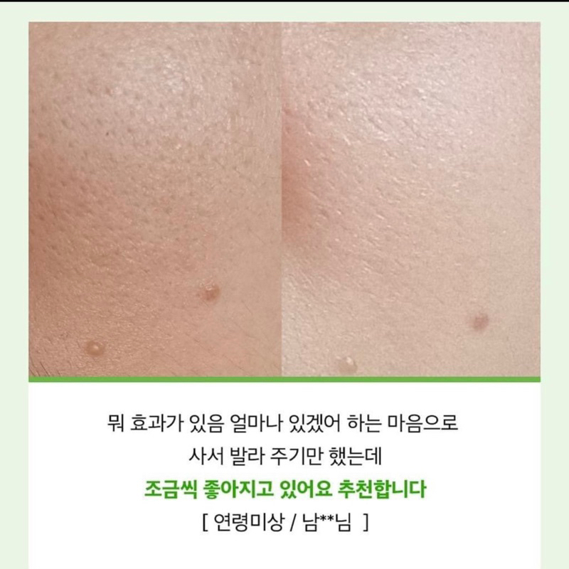 Tinh chất cà chua xanh - Hỗ trợ thu nhỏ lỗ chân lông Sungboon Editor Green Tomato PoreLifting Ampoule+ 30ml