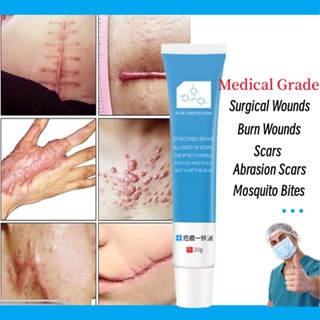 Scar Cream Scar Removal Kem sẹo sẹo lồi Loại bỏ sẹo Vết rạn da Làm mịn da Sửa chữa vết thương Vết sẹo phẫu thuật