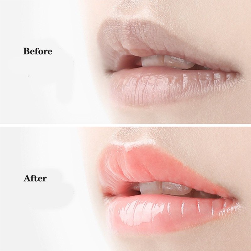 Serum Dưỡng Vùng Mắt Và Serum Dưỡng Vùng Môi Hydrafacial Perk 14ml Mỹ