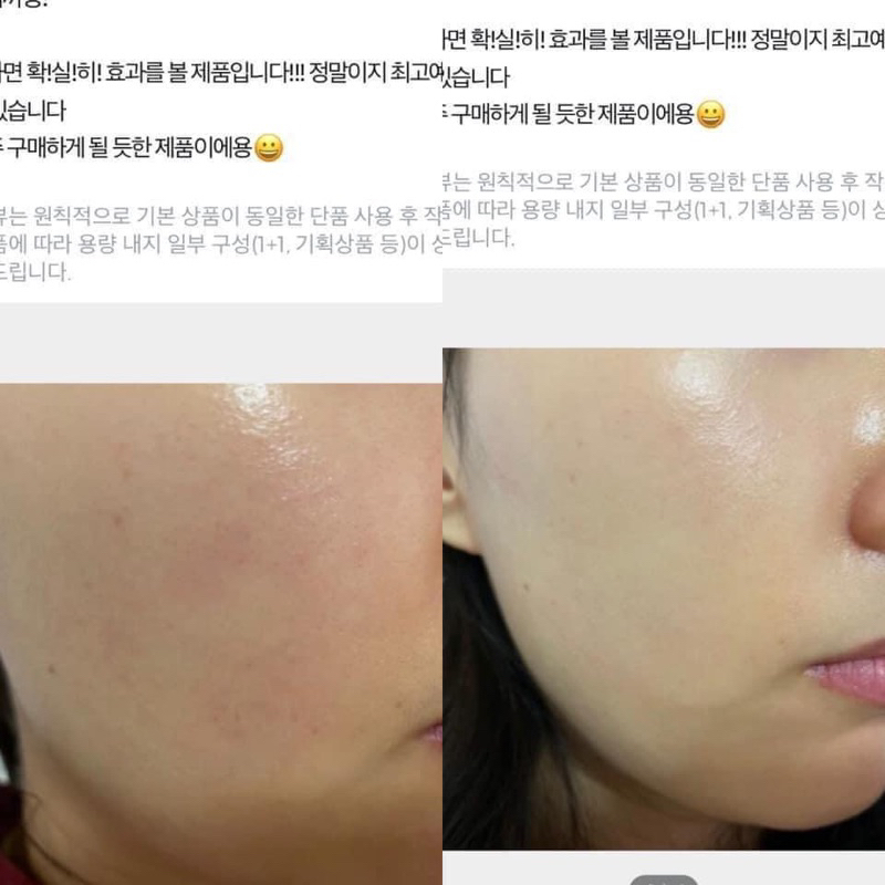 Serum dưỡng trắng da mờ thâm nám ISOI Bugarian Blemish Care Serum
