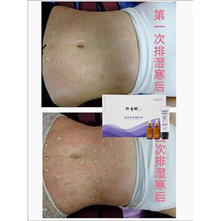 Set tình dầu và kem tan mỡ bụng