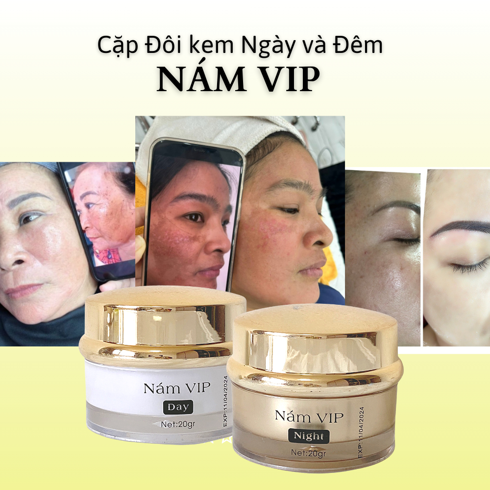 GÍA SỈ TẠI XƯỞNG  Cặp Đôi Kem Nám Da Ban Ngày và Ban Đêm, Dưỡng trắng da