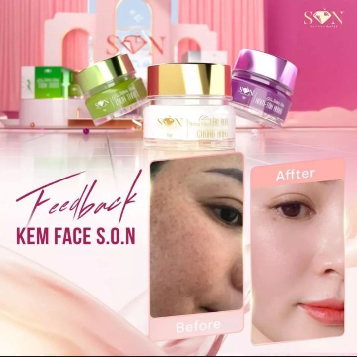 Combo 2 SP Kem Face Nám Ngày Đêm SON Tiên Nguyễn Tặng Cao Bưởi