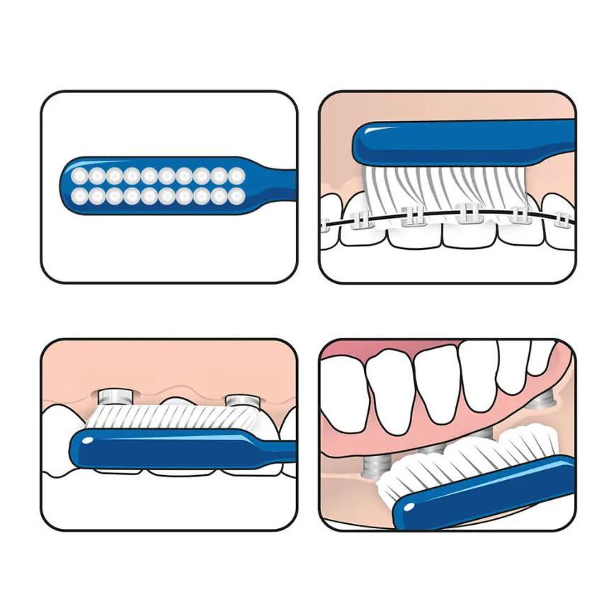 Bàn chải răng niềng, implant TePe đủ màu - Thụy Điển