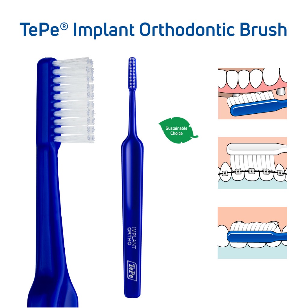 Bàn chải răng niềng, implant TePe đủ màu - Thụy Điển