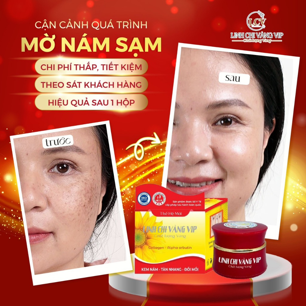 Kem Mờ Nám Tàn Nhang Đồi Mồi Linh Chi Vàng Kem Dưỡng Ngừa Lão Hoá Đều Màu Da CHAMDA 8g VIP-02