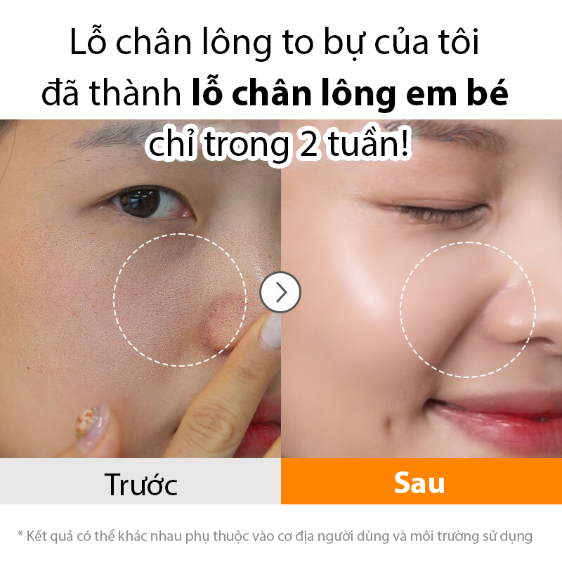 Mặt Nạ Đất Sét Làm Sạch Sâu Và Thu Nhỏ Lỗ Chân Lông - aetem Black Lemon Wash Off Pack 100ml