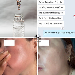 TBG Phục Hồi Da, combo 2 chai