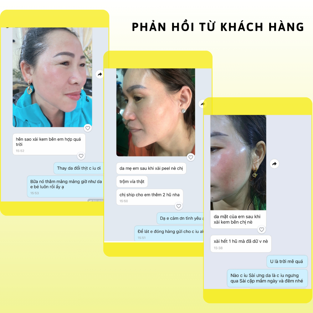 GÍA SỈ TẠI XƯỞNG  Cặp Đôi Kem Nám Da Ban Ngày và Ban Đêm, Dưỡng trắng da