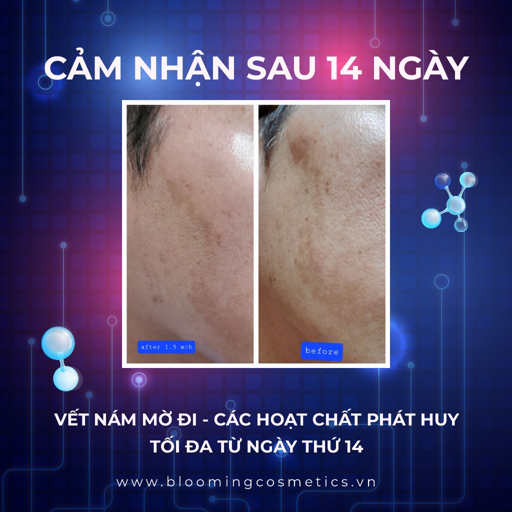 50 gói kem Dominas 1g