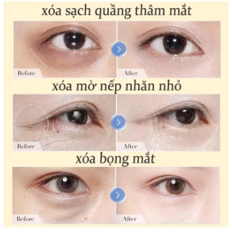 Kem dưỡng mắt chống nhăn giảm quầng thâm serum chống lão hóa cho quầng mắt kem mắt Chống bọng 25g