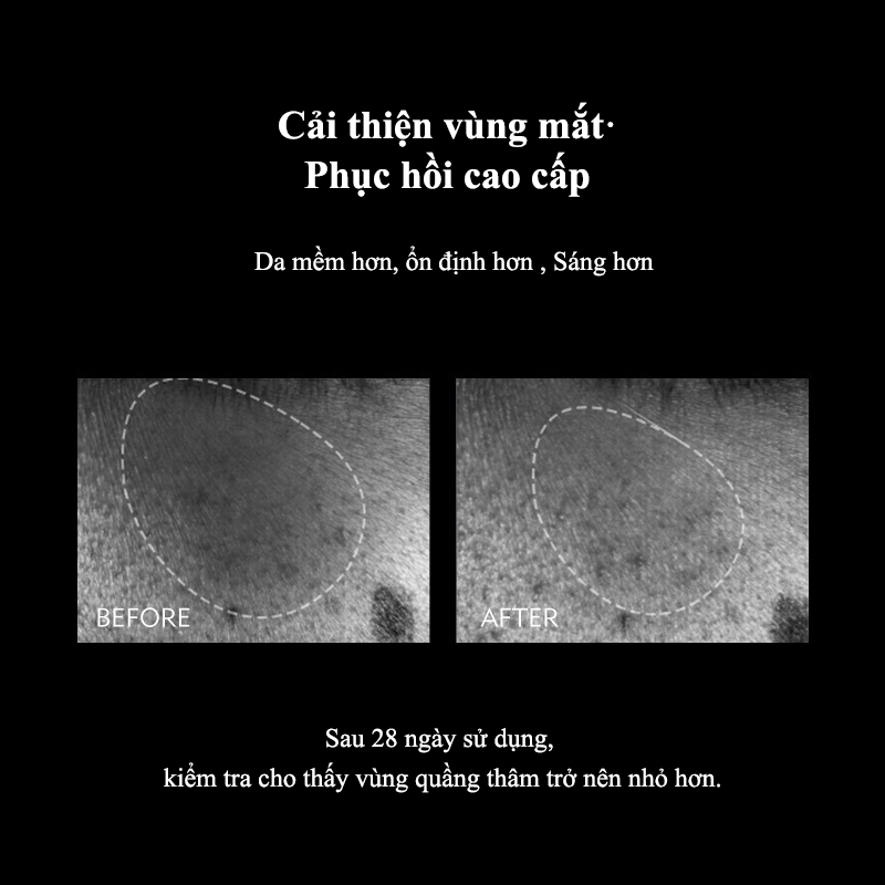 Kem dưỡng mắt chống nhăn giảm quầng thâm serum chống lão hóa cho quầng mắt kem mắt Chống bọng 25g