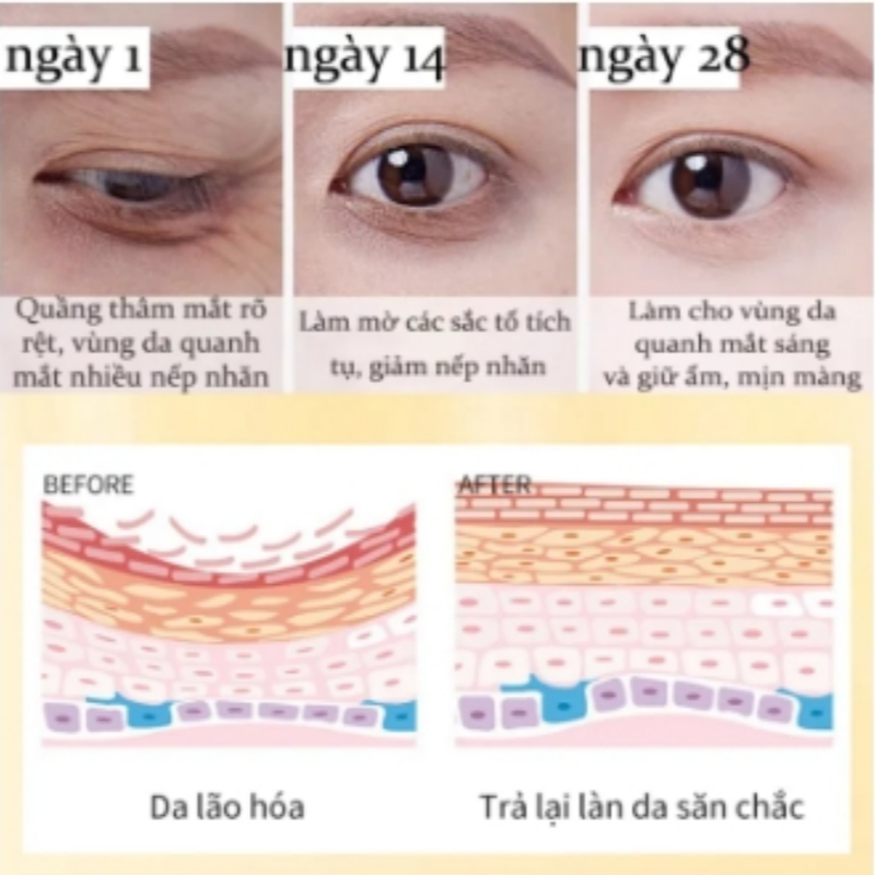 Kem dưỡng mắt chống nhăn giảm quầng thâm serum chống lão hóa cho quầng mắt kem mắt Chống bọng 25g