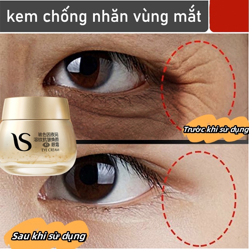 Kem dưỡng mắt chống nhăn giảm quầng thâm serum chống lão hóa cho quầng mắt kem mắt Chống bọng 25g