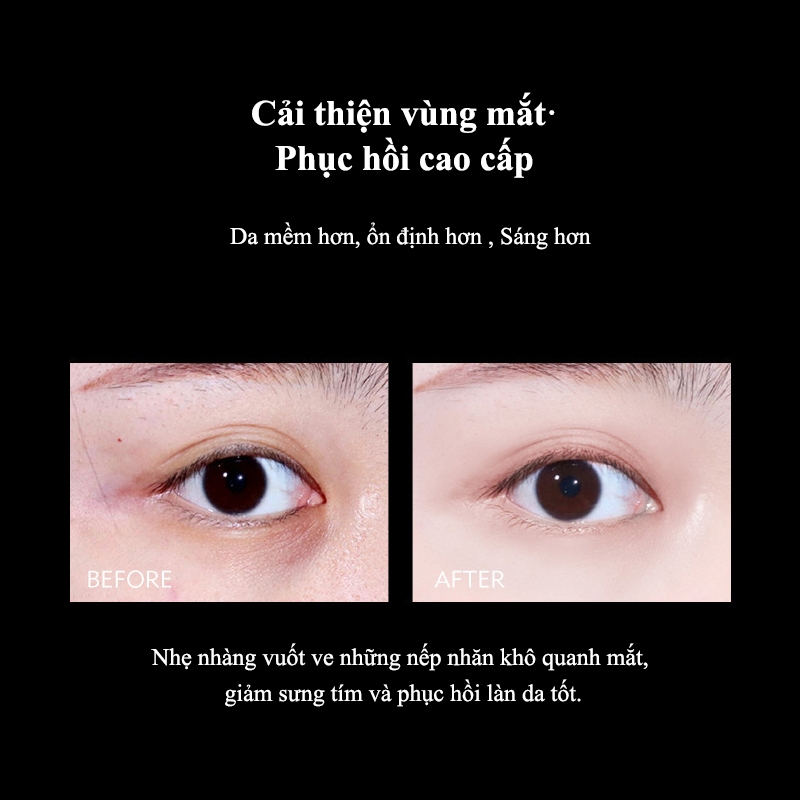 Kem dưỡng mắt chống nhăn giảm quầng thâm serum chống lão hóa cho quầng mắt kem mắt Chống bọng 25g