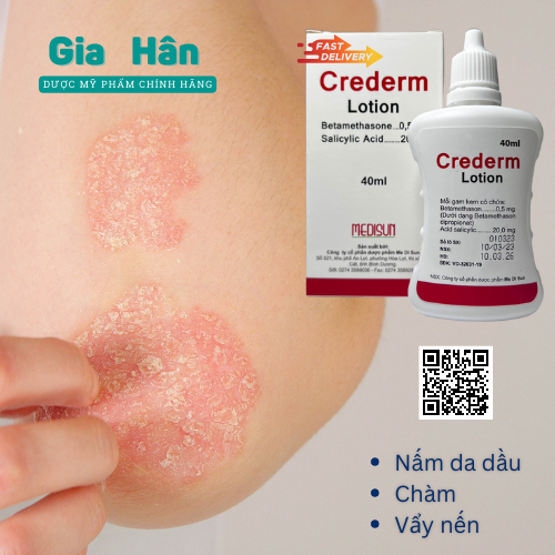 Kem dưỡng Crederm lotion 40 ml chăm sóc da Chàm, Vẩy nến, Nấm da đầu, công thức Beprosalic lotion.