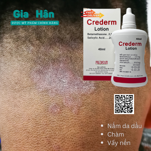 Kem dưỡng Crederm lotion 40 ml chăm sóc da Chàm, Vẩy nến, Nấm da đầu, công thức Beprosalic lotion.