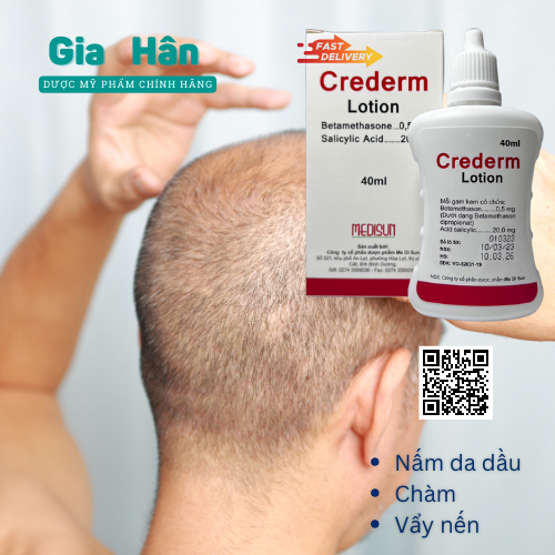 Kem dưỡng Crederm lotion 40 ml chăm sóc da Chàm, Vẩy nến, Nấm da đầu, công thức Beprosalic lotion.
