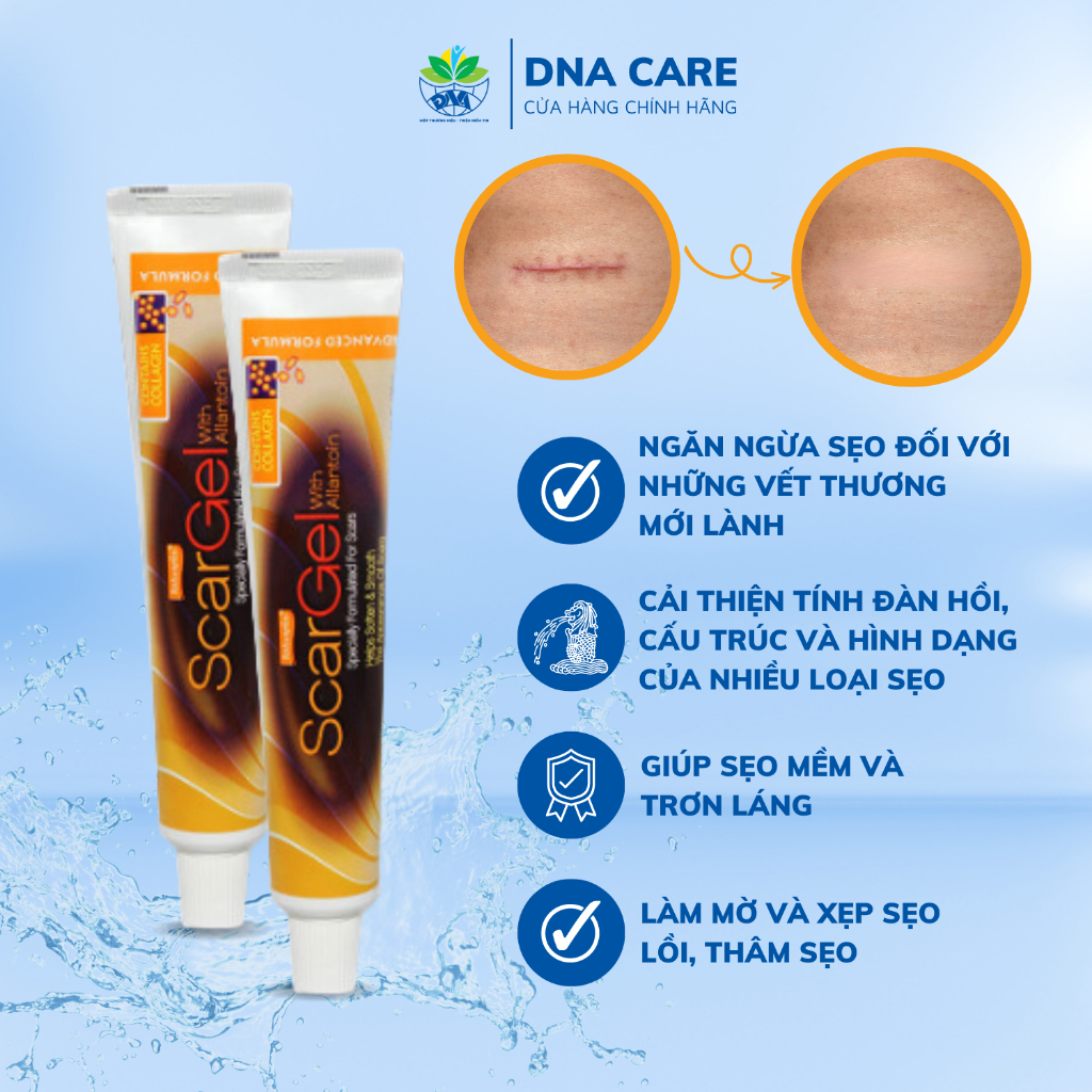 Kem làm mờ sẹo Mỹ Scargel Natureplex làm mờ sẹo lồi, sẹo thâm tuýp 35gr
