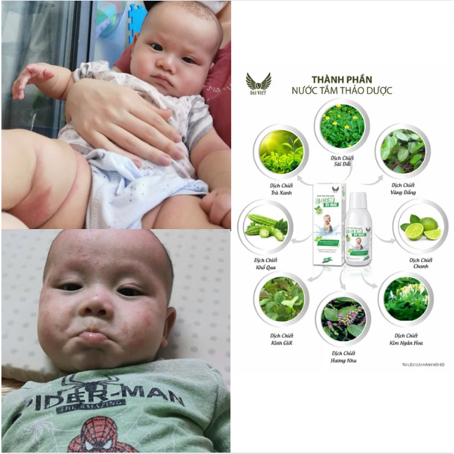 Nước tắm thảo dược cho bé